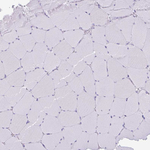 GLP2R Antibody in Immunohistochemistry (Paraffin) (IHC (P))