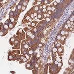 SULT1A1 Polyclonal Antibody