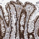 KLF3 Antibody in Immunohistochemistry (Paraffin) (IHC (P))