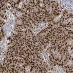 KLF3 Antibody in Immunohistochemistry (Paraffin) (IHC (P))