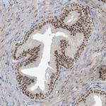 KLF3 Antibody in Immunohistochemistry (Paraffin) (IHC (P))