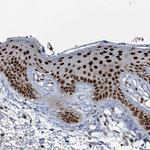 KLF3 Antibody in Immunohistochemistry (Paraffin) (IHC (P))