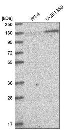PUM2 Antibody in Western Blot (WB)