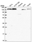 IKAP Antibody in Western Blot (WB)