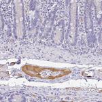 Apolipoprotein B Antibody in Immunohistochemistry (Paraffin) (IHC (P))