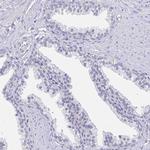 Apolipoprotein B Antibody in Immunohistochemistry (Paraffin) (IHC (P))