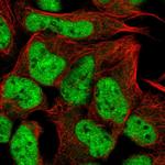 RUNX1T1 Polyclonal Antibody