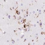 HLA-DRA Antibody in Immunohistochemistry (Paraffin) (IHC (P))