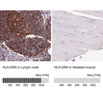HLA-DRA Antibody in Immunohistochemistry (Paraffin) (IHC (P))