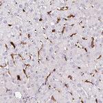HLA-DRA Antibody in Immunohistochemistry (Paraffin) (IHC (P))