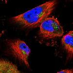 USP8 Antibody in Immunocytochemistry (ICC/IF)