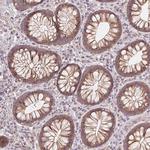 USP8 Antibody in Immunohistochemistry (Paraffin) (IHC (P))