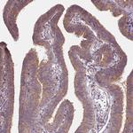 USP8 Antibody in Immunohistochemistry (Paraffin) (IHC (P))