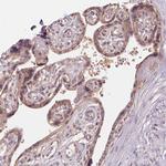 USP8 Antibody in Immunohistochemistry (Paraffin) (IHC (P))