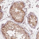 USP8 Antibody in Immunohistochemistry (Paraffin) (IHC (P))