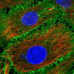 BASP1 Polyclonal Antibody