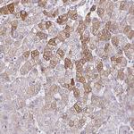 ARH Polyclonal Antibody