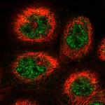 COPS3 Polyclonal Antibody