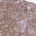IKAP Polyclonal Antibody