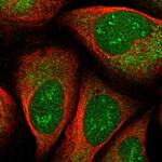 EEF1D Polyclonal Antibody