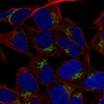 LRRC4 Antibody in Immunocytochemistry (ICC/IF)