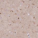 Coronin 1A Antibody in Immunohistochemistry (Paraffin) (IHC (P))