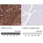 Coronin 1A Antibody in Immunohistochemistry (Paraffin) (IHC (P))