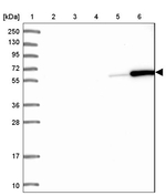 Coronin 1A Antibody in Western Blot (WB)