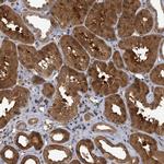 FBXO6 Polyclonal Antibody