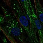 Aromatase Polyclonal Antibody
