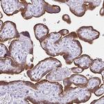 Aromatase Antibody in Immunohistochemistry (Paraffin) (IHC (P))