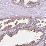 Aromatase Antibody in Immunohistochemistry (Paraffin) (IHC (P))