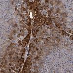 TRPC4AP Polyclonal Antibody