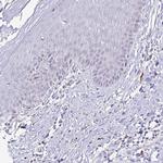 NOX2 Antibody in Immunohistochemistry (Paraffin) (IHC (P))