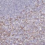 NOX2 Antibody in Immunohistochemistry (Paraffin) (IHC (P))