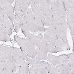 NOX2 Antibody in Immunohistochemistry (Paraffin) (IHC (P))