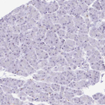 NOX2 Antibody in Immunohistochemistry (Paraffin) (IHC (P))