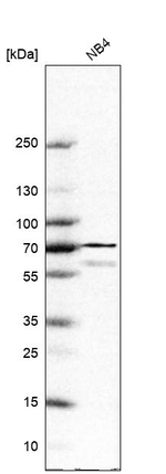NOX2 Antibody in Western Blot (WB)