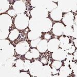 D4-GDI Antibody in Immunohistochemistry (Paraffin) (IHC (P))
