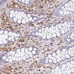 D4-GDI Antibody in Immunohistochemistry (Paraffin) (IHC (P))