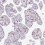 D4-GDI Antibody in Immunohistochemistry (Paraffin) (IHC (P))