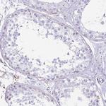 D4-GDI Antibody in Immunohistochemistry (Paraffin) (IHC (P))