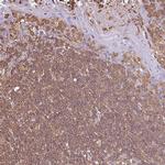 D4-GDI Antibody in Immunohistochemistry (Paraffin) (IHC (P))