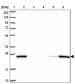 D4-GDI Antibody in Western Blot (WB)