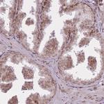 TMC6 Polyclonal Antibody