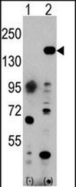 EHMT1 Polyclonal Antibody