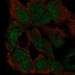 ZFP82 Polyclonal Antibody