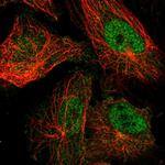 TRPM7 Antibody in Immunocytochemistry (ICC/IF)