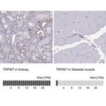 TRPM7 Antibody in Immunohistochemistry (Paraffin) (IHC (P))