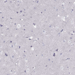 TRPM7 Antibody in Immunohistochemistry (Paraffin) (IHC (P))